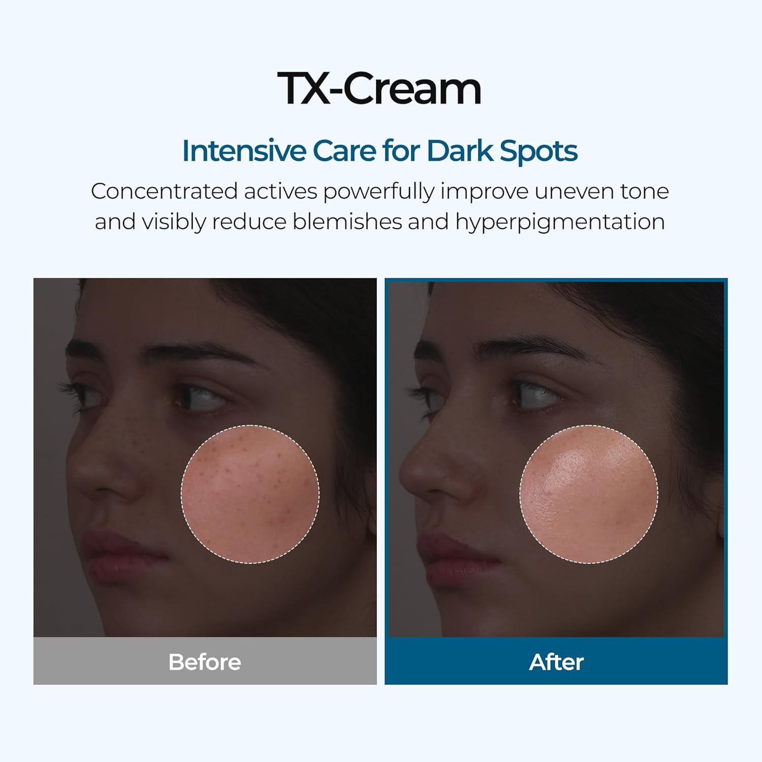Korean Tranexamic Acid CREAM