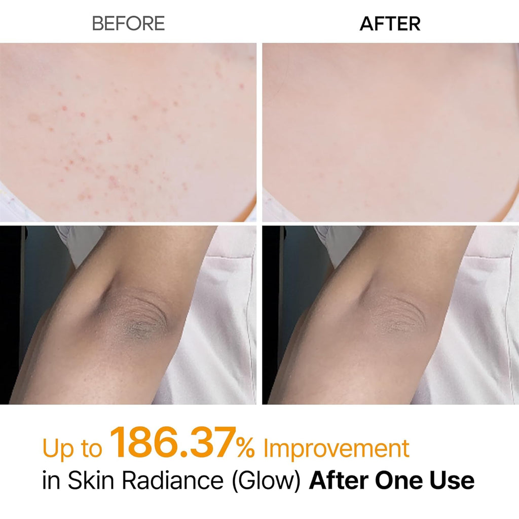 Korean Keratin Care Kojic Acid Tumeric Spray