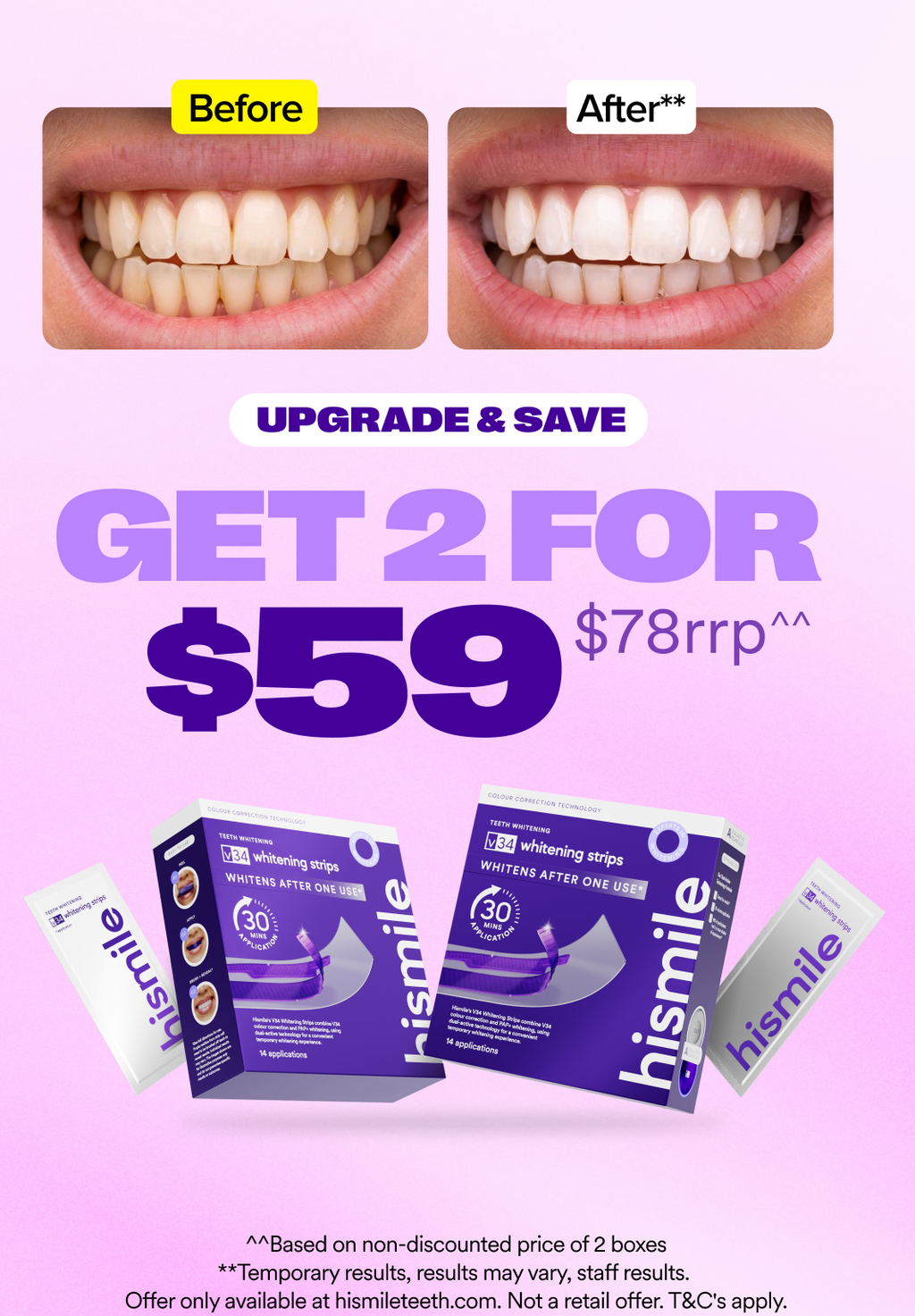 V34 Whitening Strips - Value 2 Pack
