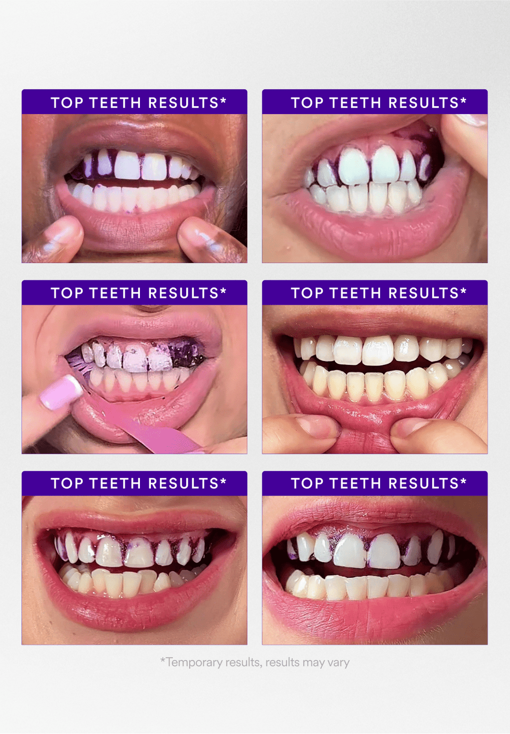 V34 Whitening Strips - Value Deal