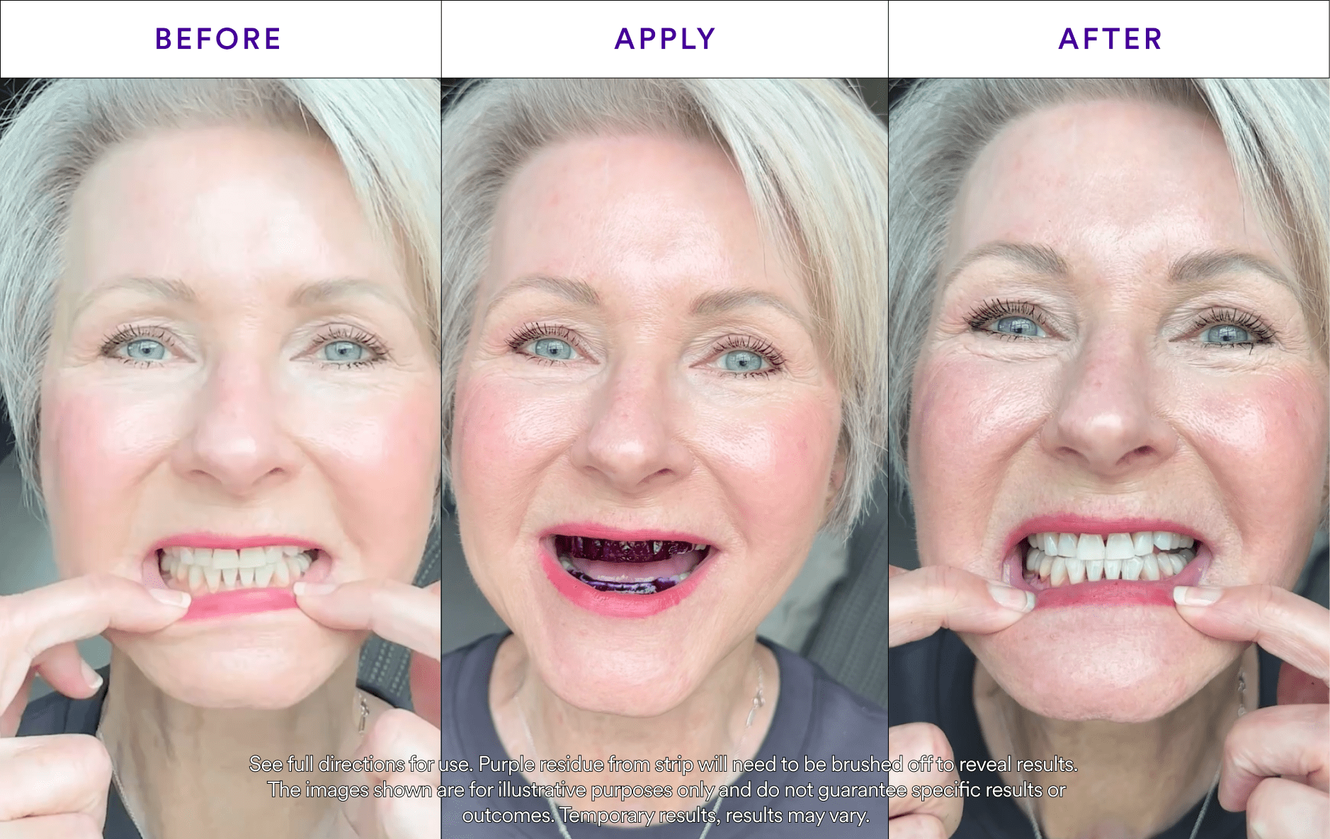 V34 Whitening Strips - Value Deal